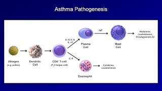 Asthma and COPD  Pathogenesis and Pathophysiology [upl. by Hilary213]