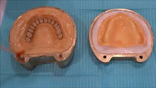 Processing of Complete dentures [upl. by Astri]