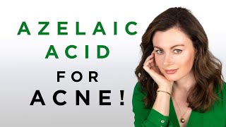 My Favourite Acne Treatments  Azelaic Acid  Dr Sam Bunting [upl. by Nivrehs701]