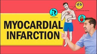 Myocardial Infarction Heart Attack for Nursing amp NCLEX [upl. by Pratt164]