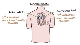 Heart Murmurs and Heart Sounds Visual Explanation for Students [upl. by Mutat]