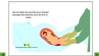 les étapes de laccouchement [upl. by Rennane]