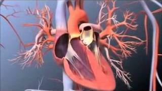 Pulmonary Artery Catheterization [upl. by Larok]