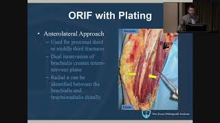 Humeral Shaft Fractures  John Callaghan MD [upl. by Hillegass]