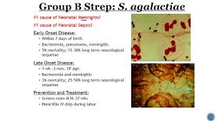 Group B Streptococcus GBS [upl. by Robena]